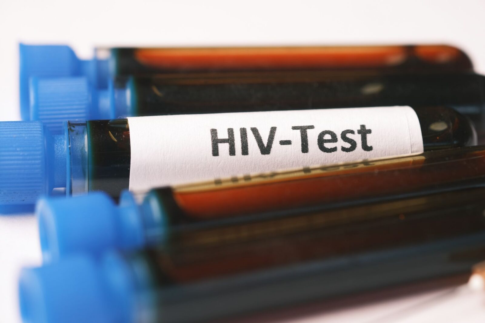 Fiji Declares HIV a National Crisis Amid Surge in Diagnoses