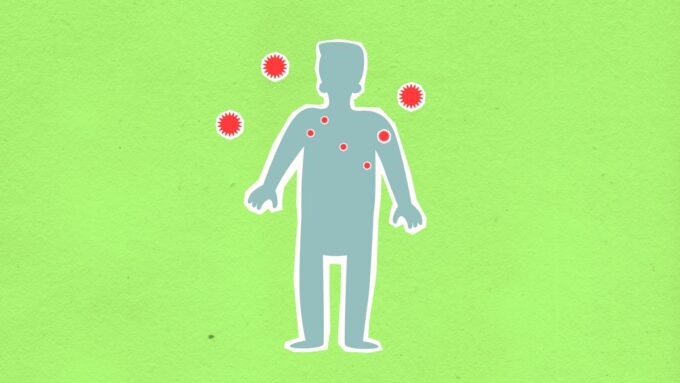 Pennsylvania Seeks CDC Assistance Amid Measles Outbreak and Vaccine Controversy