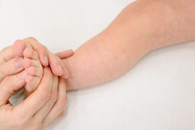 Confirmed Measles Case Raises Public Health Concerns in Tuscola County