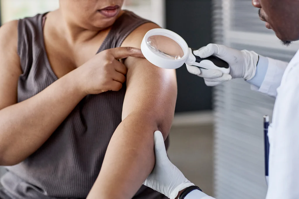 Skin cancer detection tools powered by AI are improving. Not everyone is benefitting