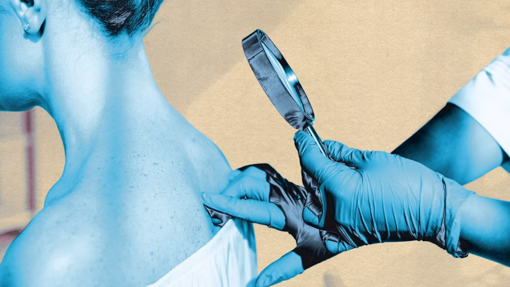 Skin cancer detection tools powered by AI are improving. Not everyone is benefitting